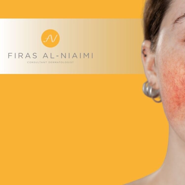 Rosacea Face Symptoms vs General Facial Redness: How To Tell The Difference